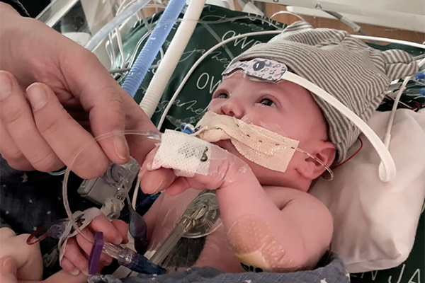 baby in a bassinette wearing a hat with various medical sensors attached