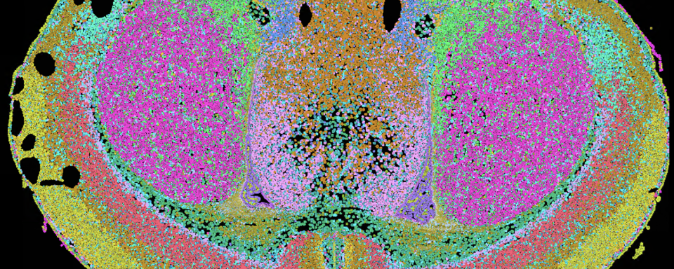 Colorful brain scan
